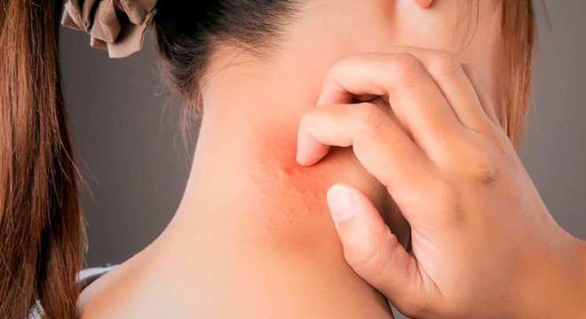 Alergias e dermatites